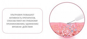 Bio Sonic 770S Ультразвуковой Bio Sonic 770S 
